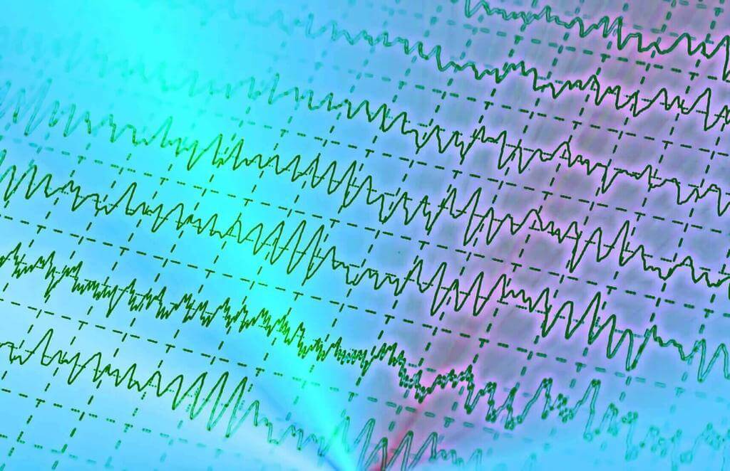Fases del sueño y ondas cerebrales